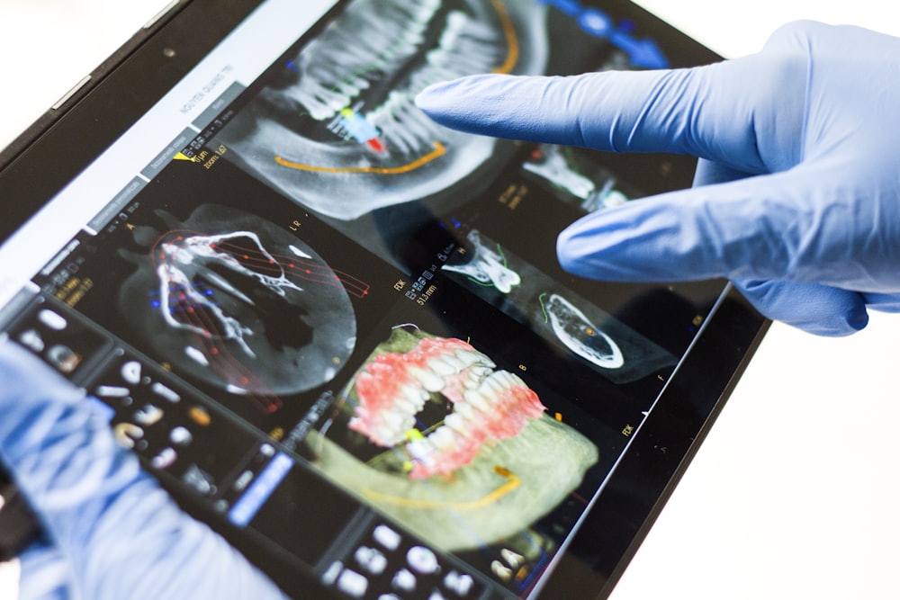 A 3D CBCT dental scan used to plan an implant