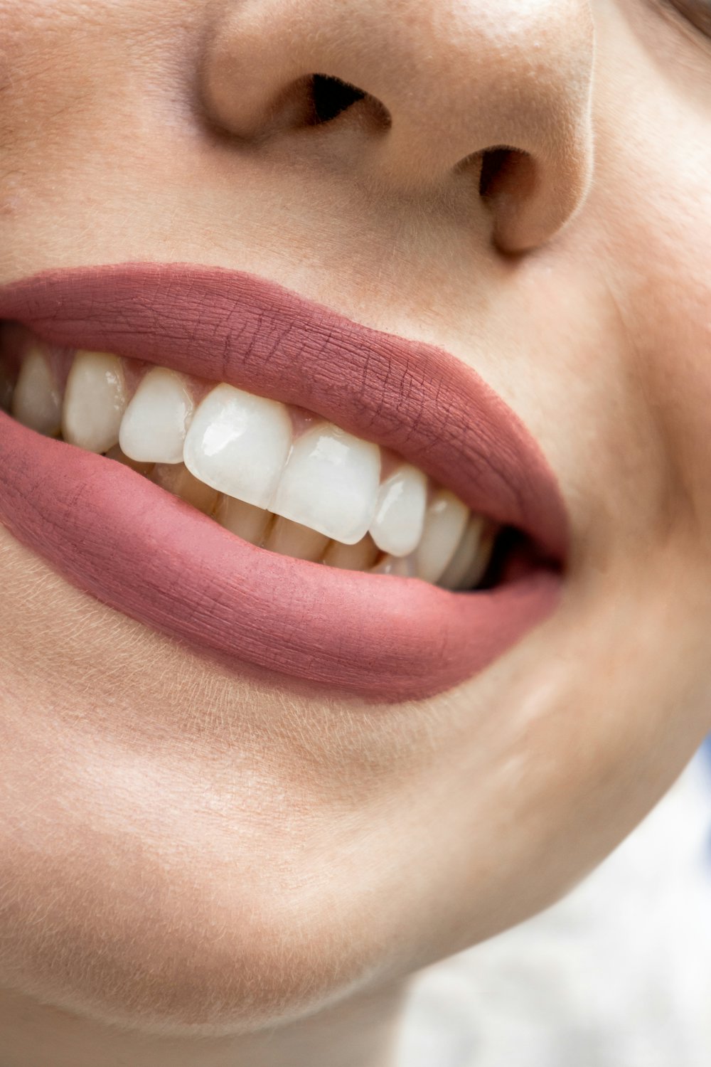Natural-looking result from a London dental implant provider